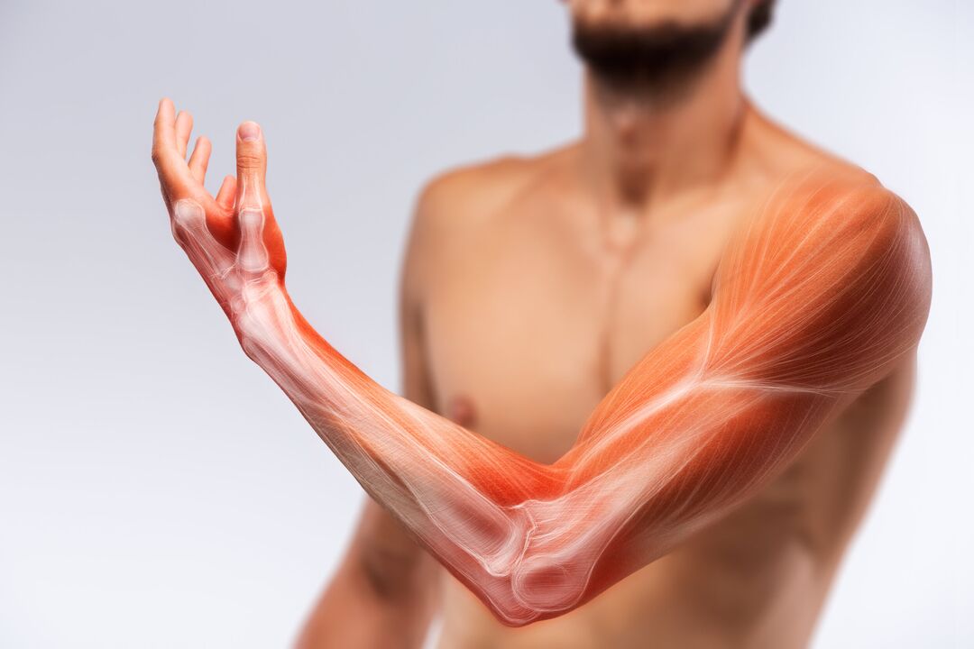 Muscles de la main et leur traitement avec un traitement Congelum -gel
