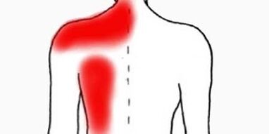 Douleur sous l'omoplate gauche par derrière
